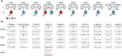 ADGRV1 Variants in Febrile Seizures/Epilepsy With Antecedent Febrile Seizures and Their Associations With Audio-Visual Abnormalities